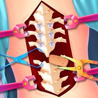 Scoliosis Surgery Game
