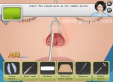 Nose Surgery: Nose Surgery Cosmetic