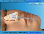 Virtual Nose Job Surgery: Gameplay