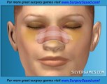 Виртуальная хирургия носа: Nose Operation
